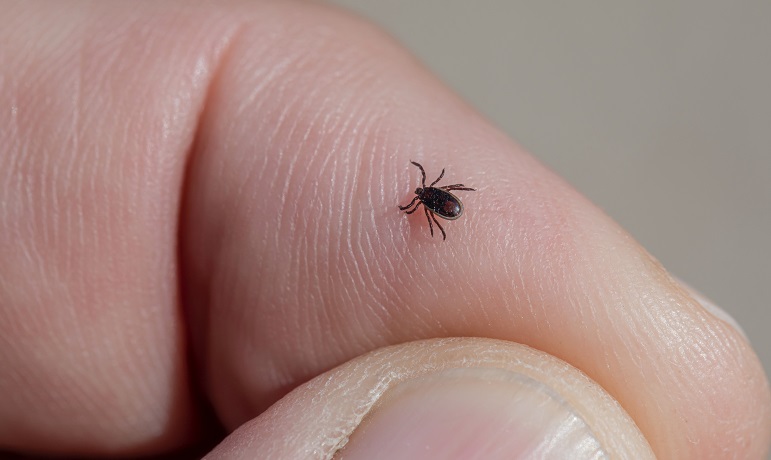 Study Shows Difficulty in Predicting Long-Term Lyme Disease Symptoms